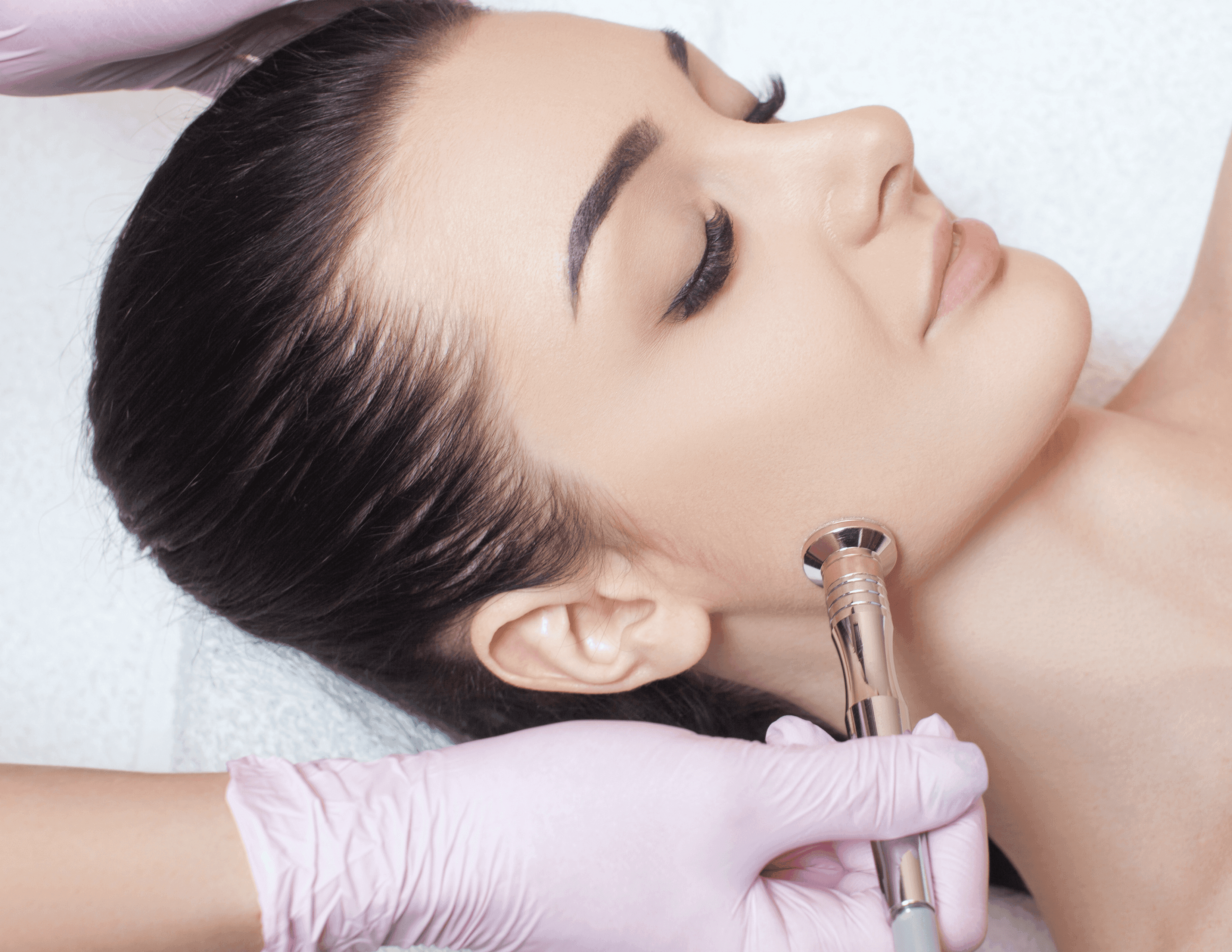 MicroDermabrasion