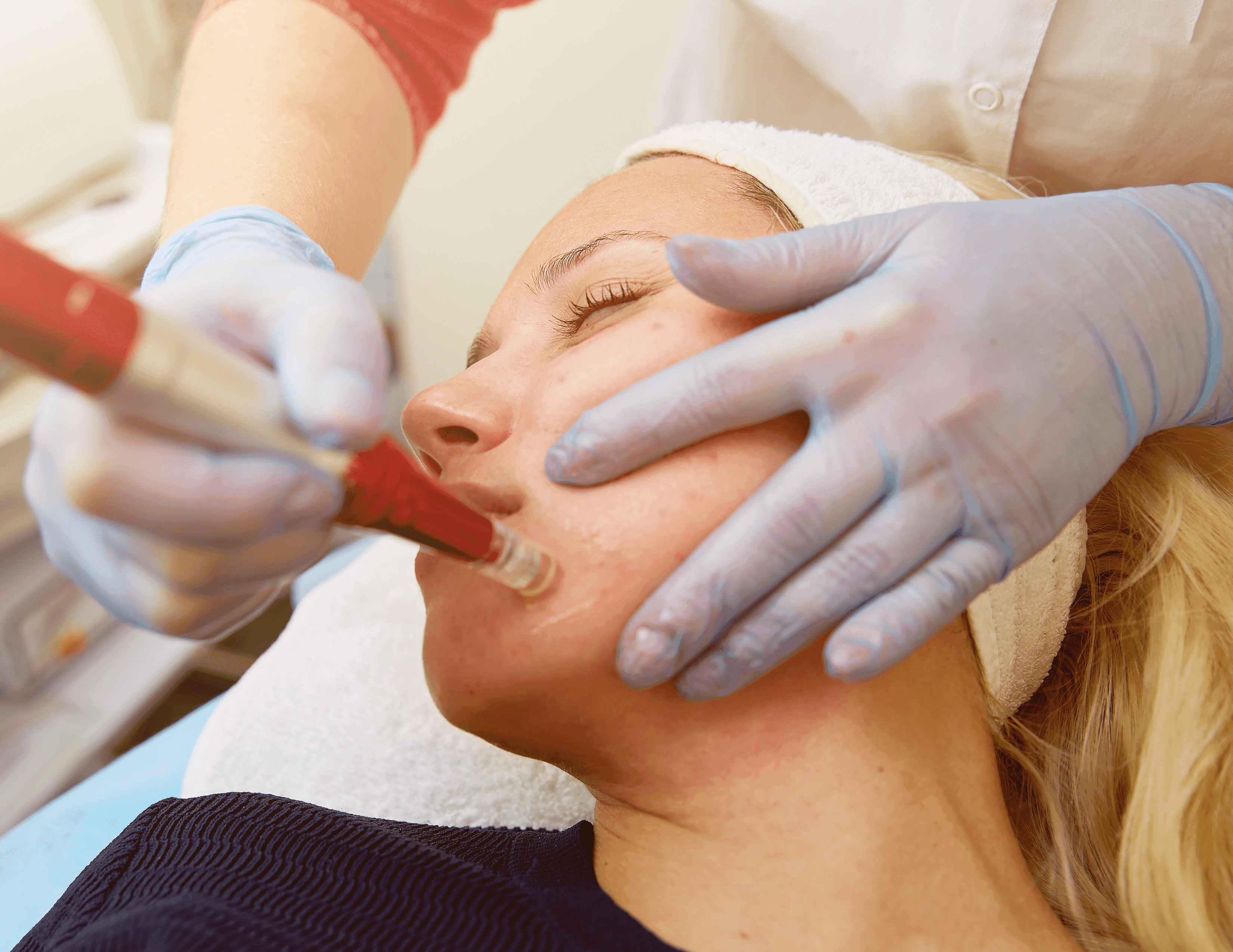 Hydra Facial + MicroNeedling